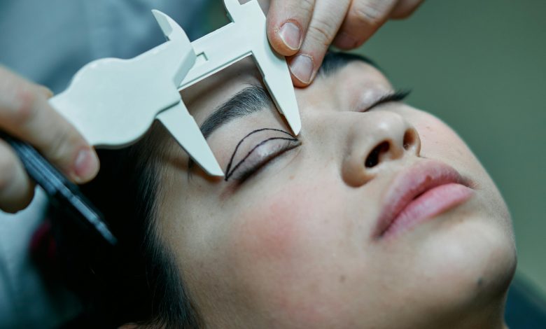 Consider Eyelid Surgery